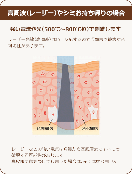 高周波（レーザー）やシミお持ち帰りの場合
