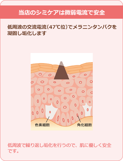 当店のシミケアは微弱電流で安全